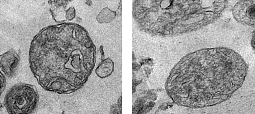 Investigadores detectan por primera vez mitocondrias en la sangre