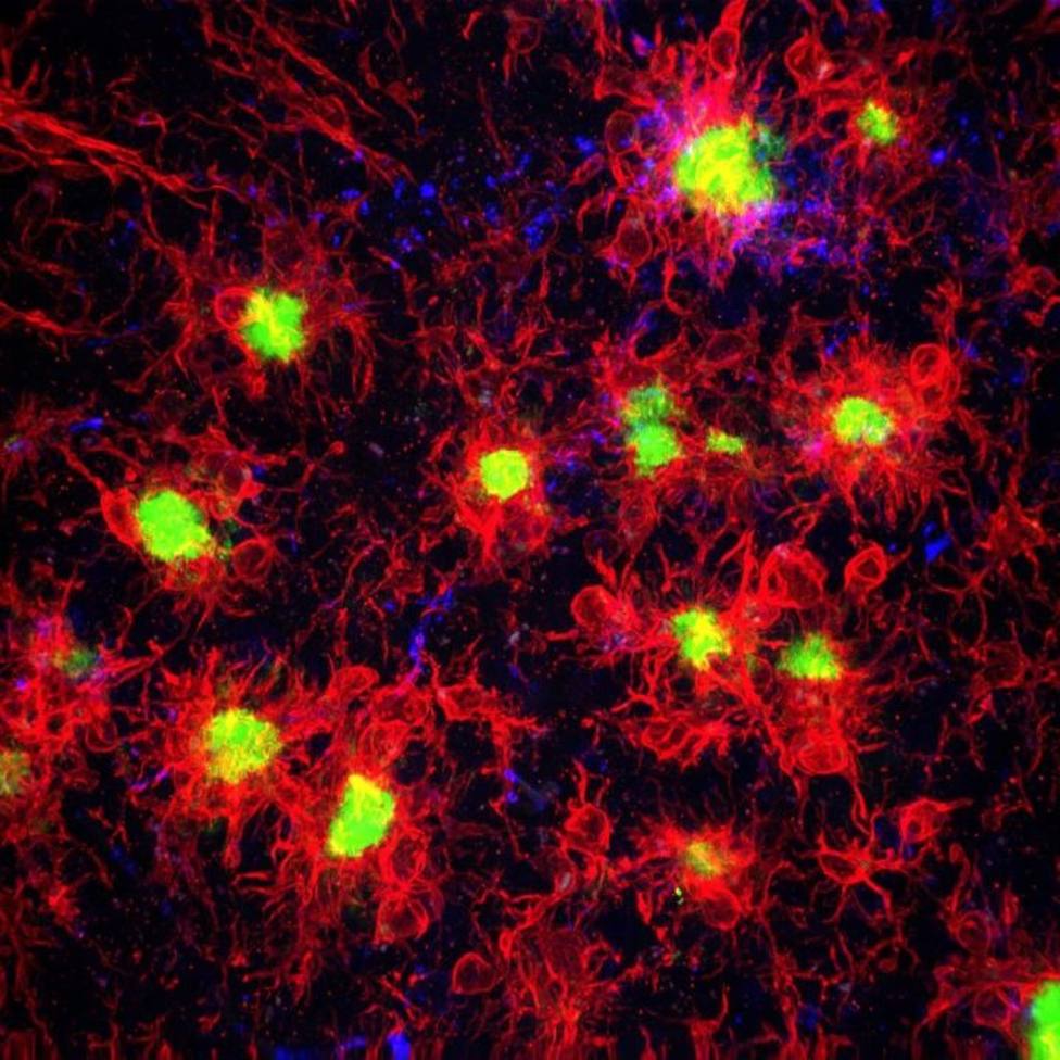 Identifican un vínculo entre las células inmunes del cerebro y el desarrollo de la enfermedad de Alzheimer