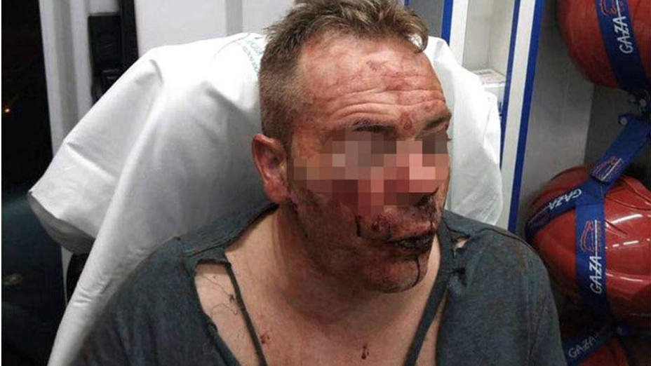 Agredido brutalmente un policía de paisano: Me dio puñetazos como una fiera