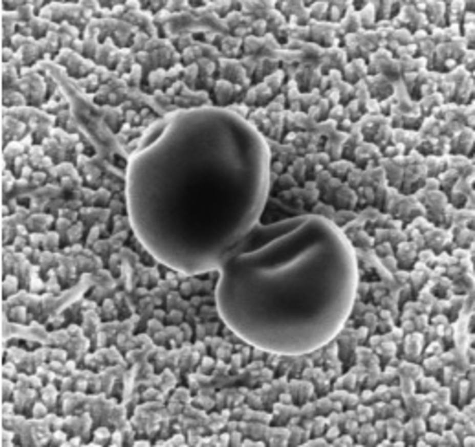 Investigadores del CSIC crean nanoestructuras capaces de proteger a los implantes de las infecciones