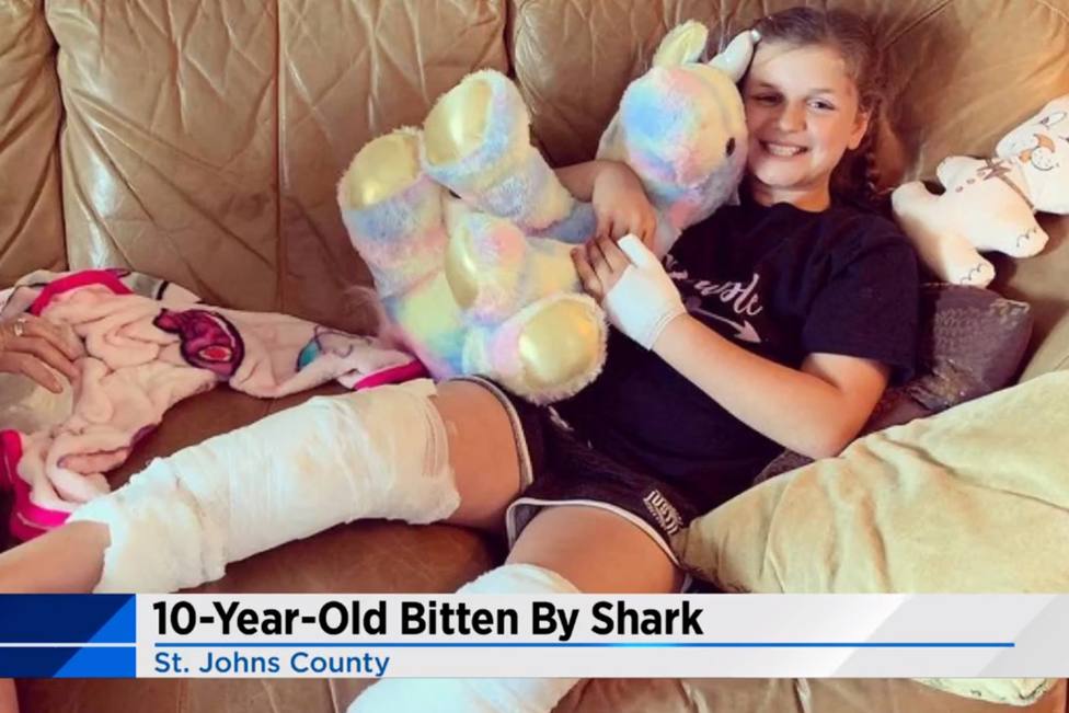 El terrible ataque de un tiburón a una niña de 10 años