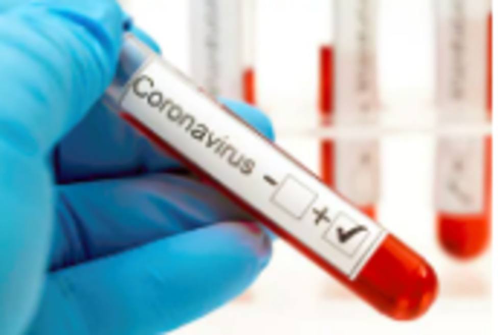 Miles de vecinos de Torrejón pasan los test para saber si tienen o han tenido coronavirus