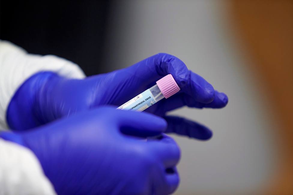 Los PCR caseros de saliva llegan a España: así funcionan