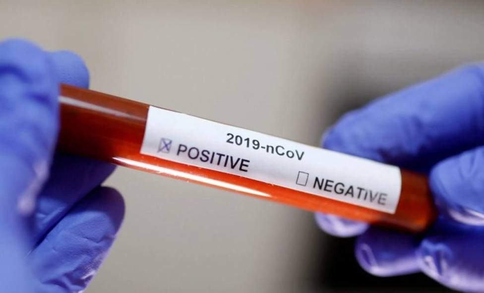 Prueba de la PCR para detectar el coronavirus. Foto: agencias