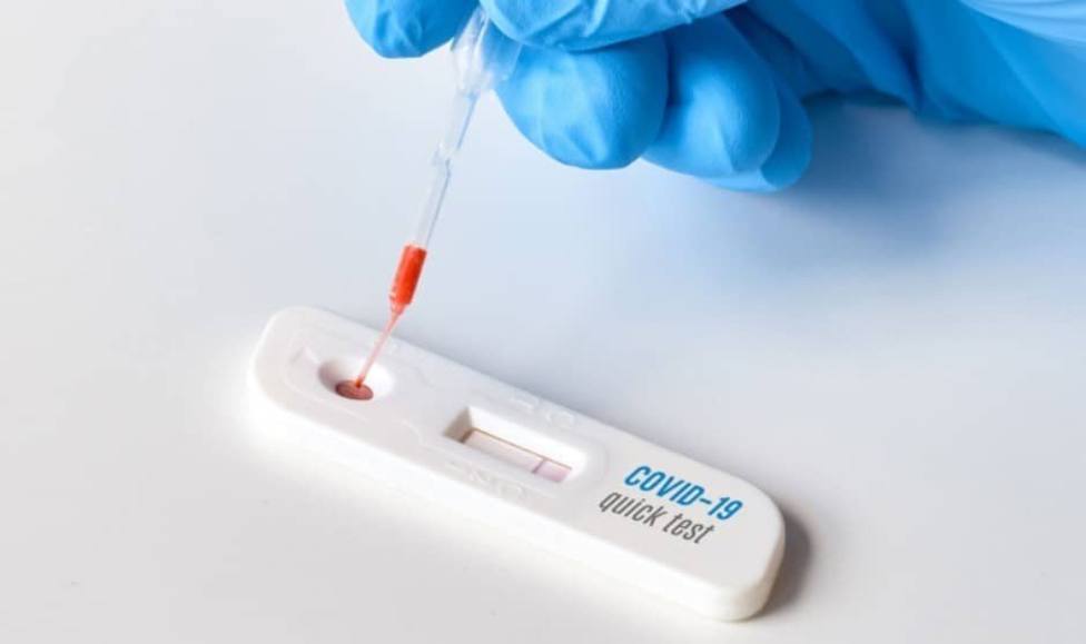 ctv-avp-son-efectivos-y-tienen-fiabilidad-los-test-de-antigenos-de-la-farmacia
