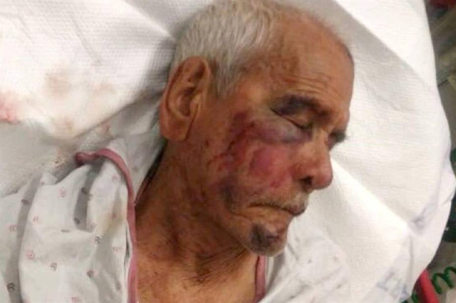 Un mexicano de 91 años, apaleado por una turba racista en EE.UU.