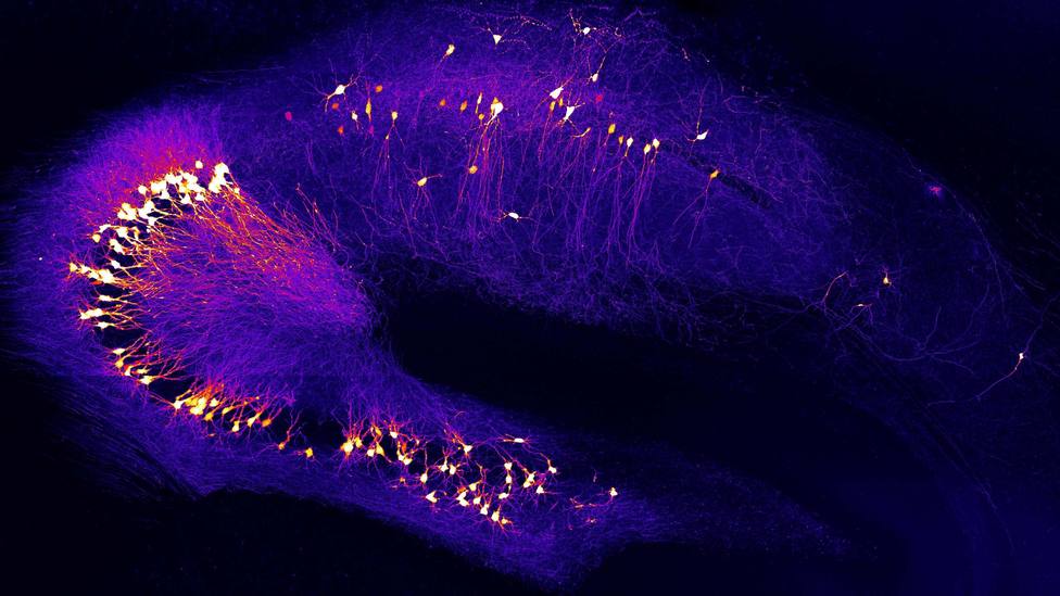 Investigadores explican por qué algunas neuronas son hiperactivas en el inicio del Alzheimer
