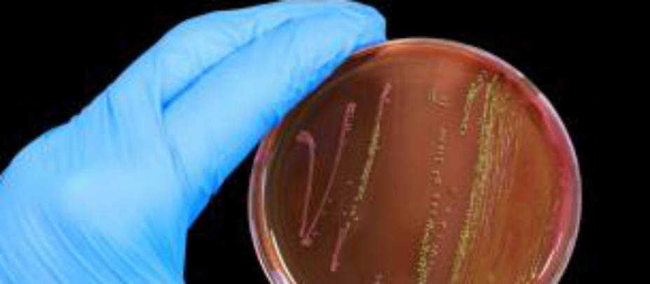 Es necesario investigar para conseguir nuevos antibióticos