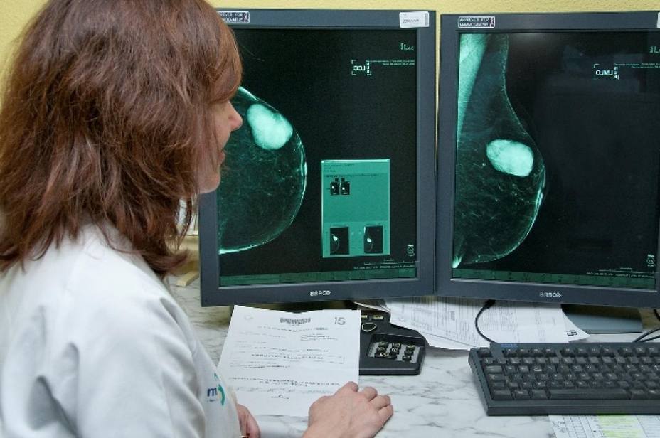 Las mamografías siguen aportando beneficios a las mujeres mayores de 75 años