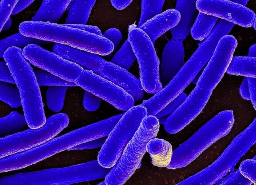 La falta de oxígeno en el intestino grueso favorece la aparición de infecciones por E. coli, según un estudio