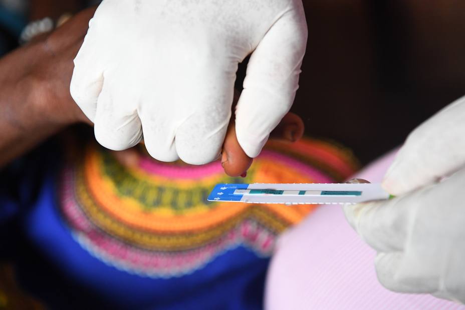 Investigadores identifican un marcador que podría ayudar a mejorar el tratamiento del VIH