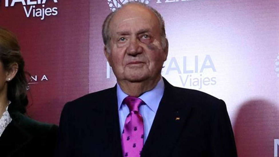 El rey Juan Carlos reaparece en público con el ojo izquierdo morado