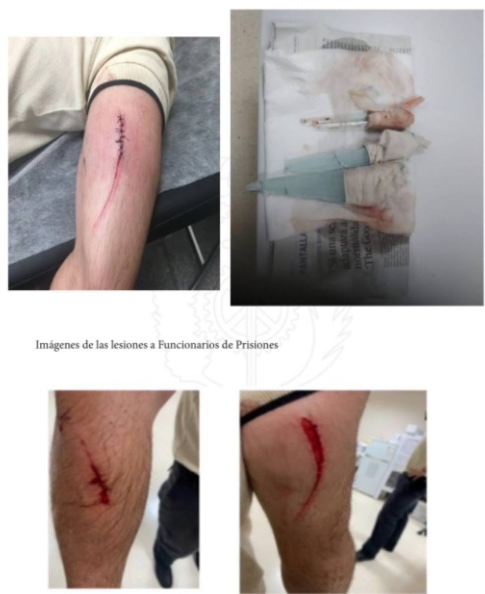 Heridas ocasionadas a los funcionarios de la prisión