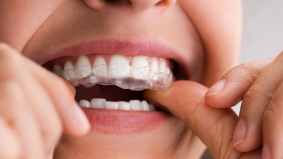 ¿Por qué la supervisión profesional es clave en ortodoncia?