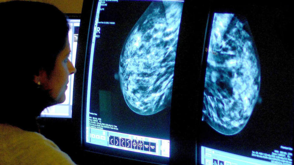 Más de 15.000 personas llevan esperando más de dos meses para hacerse una radiografía