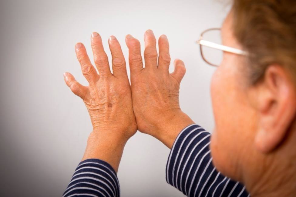 El dolor artrítico reumatoide podría ser causado por anticuerpos, según una investigación