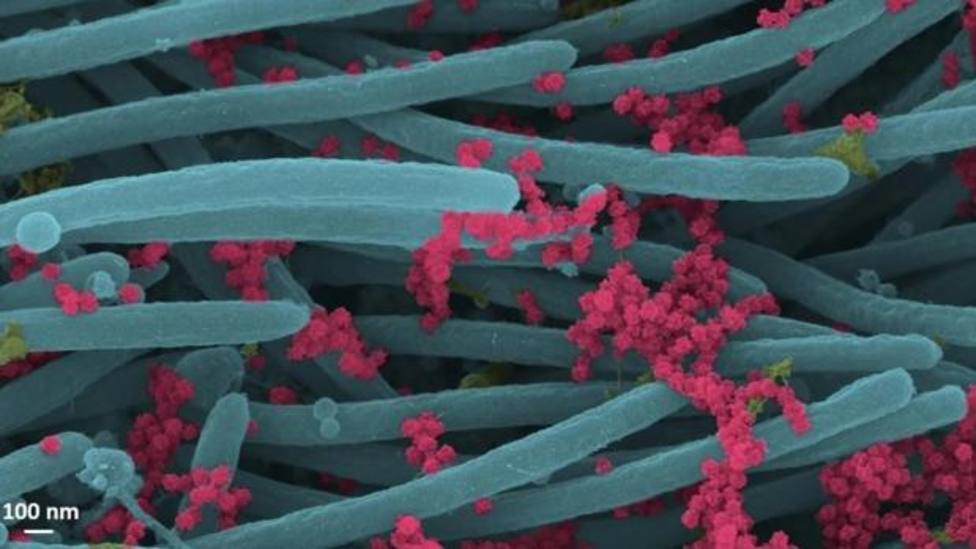 Virus -en rosa- sobre los cilios respiratorios