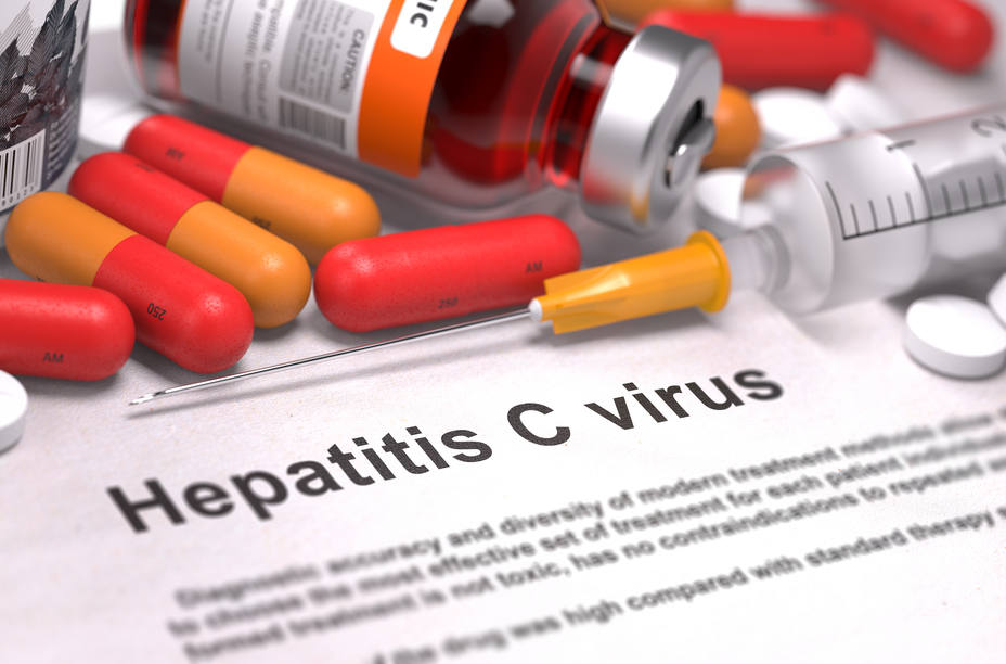 70.000 españoles tienen hepatitis C y lo desconocen