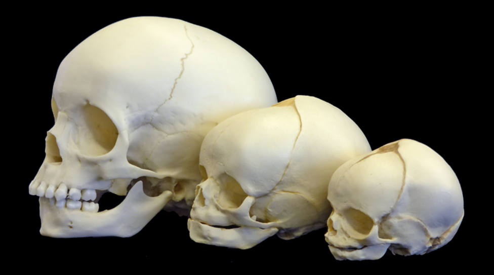 Cráneos humanos.