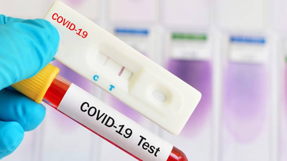 ctv-4j6-test-coronavirus-1280x720