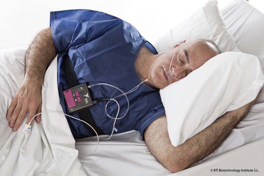 La apnea obstructiva del sueño es más frecuente y grave en los pacientes con hipertensión arterial refractaria