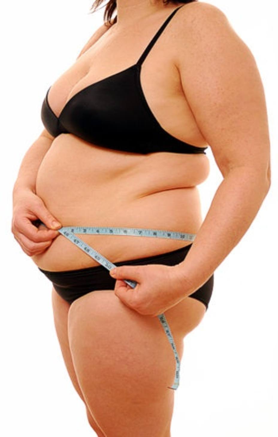 La forma en la que el cuerpo almacena la grasa influye en la aparición de patologías relacionadas con la obesidad