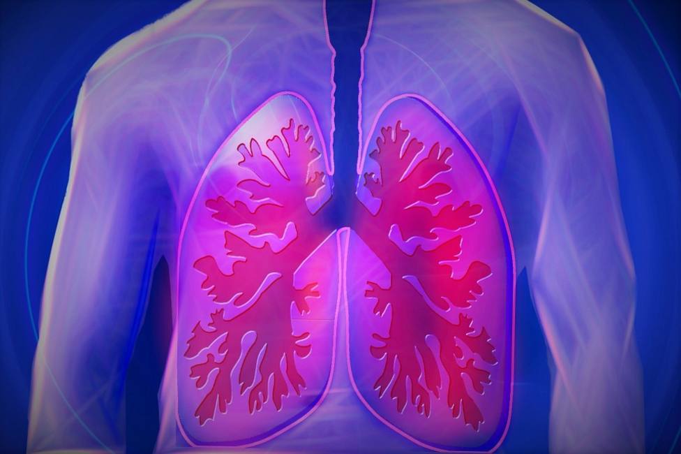 Descubren un tratamiento que reduce el cáncer de pulmón en el 80 % de pacientes