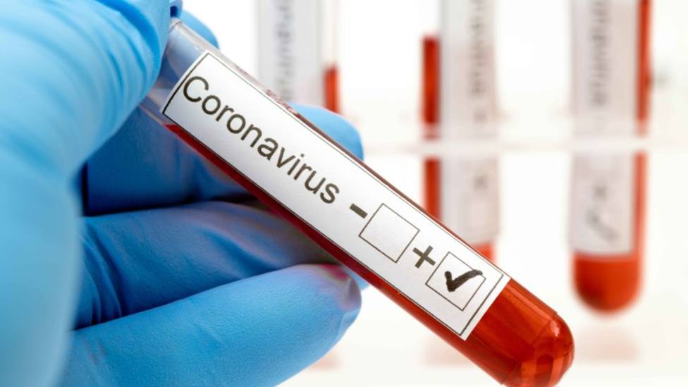 Gran Canaria vuelve a superar los 100 contagios por coronavirus y hay que lamentar 1 fallecido más