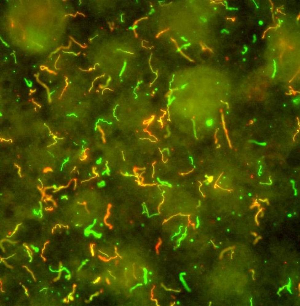 Tres cócteles de antibióticos eliminan las bacterias de Lyme resistentes a medicamentos en un estudio con ratones