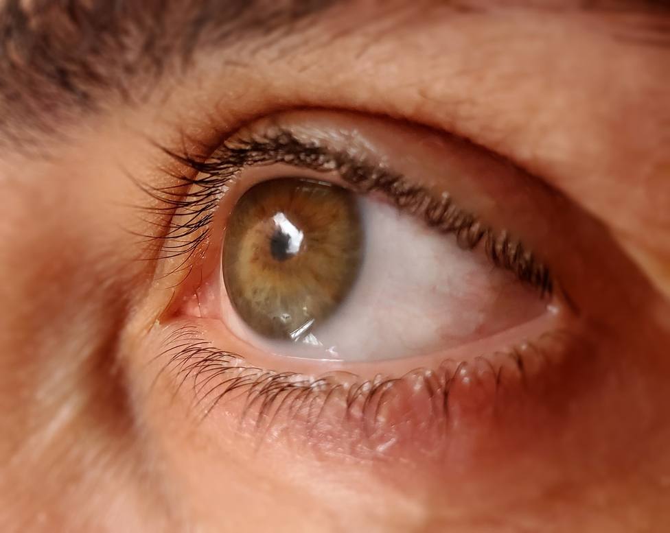 Semana Mundial del Glaucoma: La ceguera silenciosa