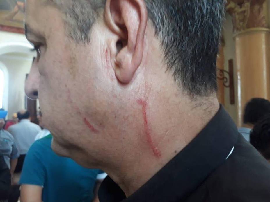 Uno de los agredidos en un templo en Nicaragua. @Artículo66