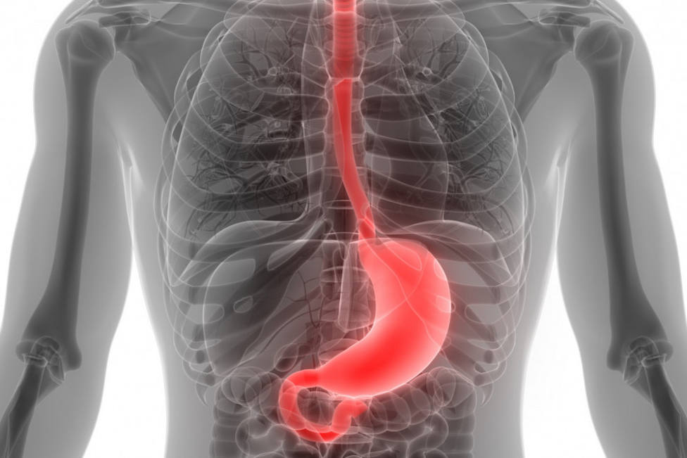 Los síntomas aparentemente leves que podrían avisarnos de un cáncer de estómago