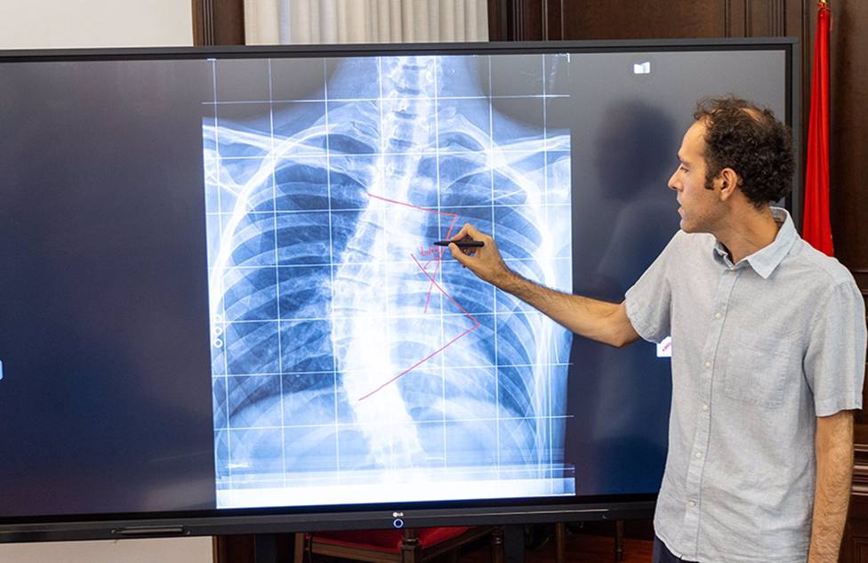 La UCAM lidera una investigaciÃ³n para crear un dispositivo que mejora la calidad de las radiografÃ­as