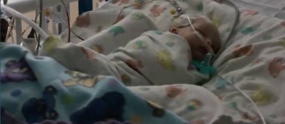 Un bebé de tres semanas operado de un aneurisma con superglue