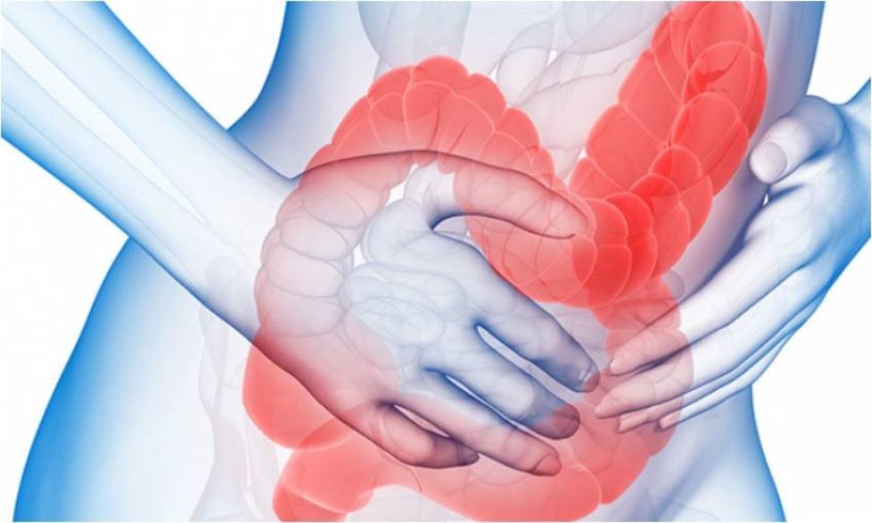 Hasta un tercio de los pacientes con enfermedad inflamatoria intestinal puede tener artritis, según experta