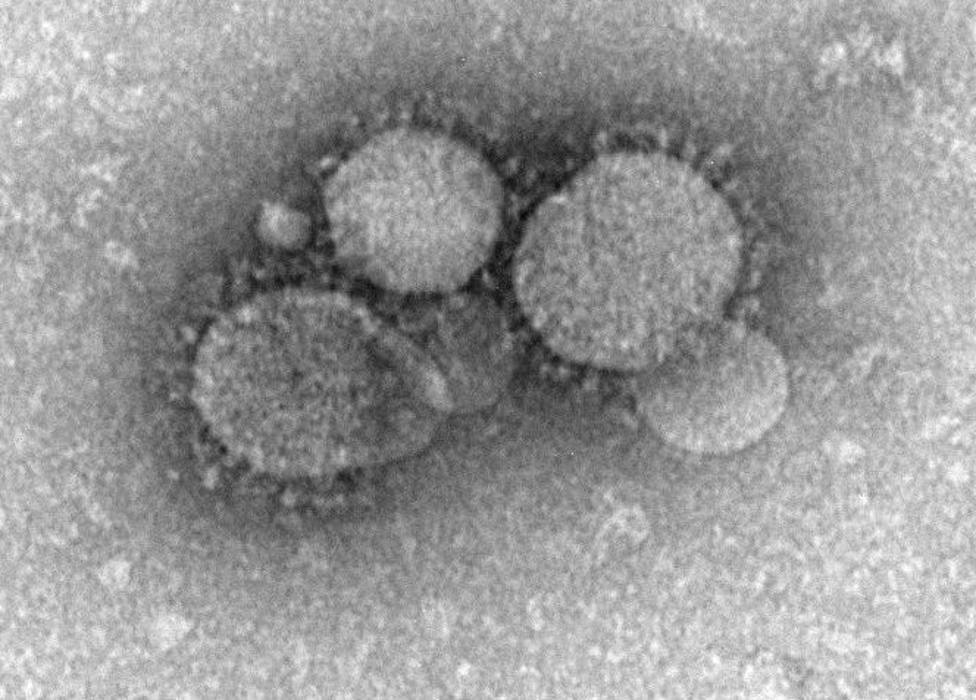 ctv-r2n-coronavirus