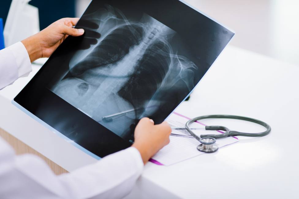 Un profesional analizando una radiografía de tórax