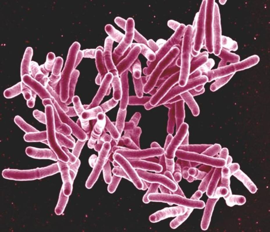 Investigan un nuevo antibiótico contra la tuberculosis que podría reducir el tiempo de tratamiento