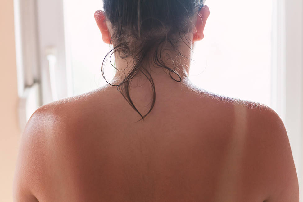 Detecta a tiempo el cáncer de piel: estos son los cuatro síntomas que deben ponerte en alerta