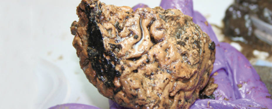Un cerebro de hace 2.600 años encontrado por científicos ingleses. York Archaeological Trust
