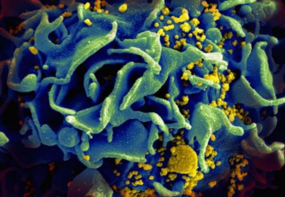 Investigadores sugieren que el VIH se esconde en los ganglios linfáticos del bazo y del intestino