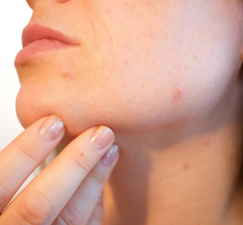 Exantemas o placas rojizas; los devastadores efectos de la covid en la piel