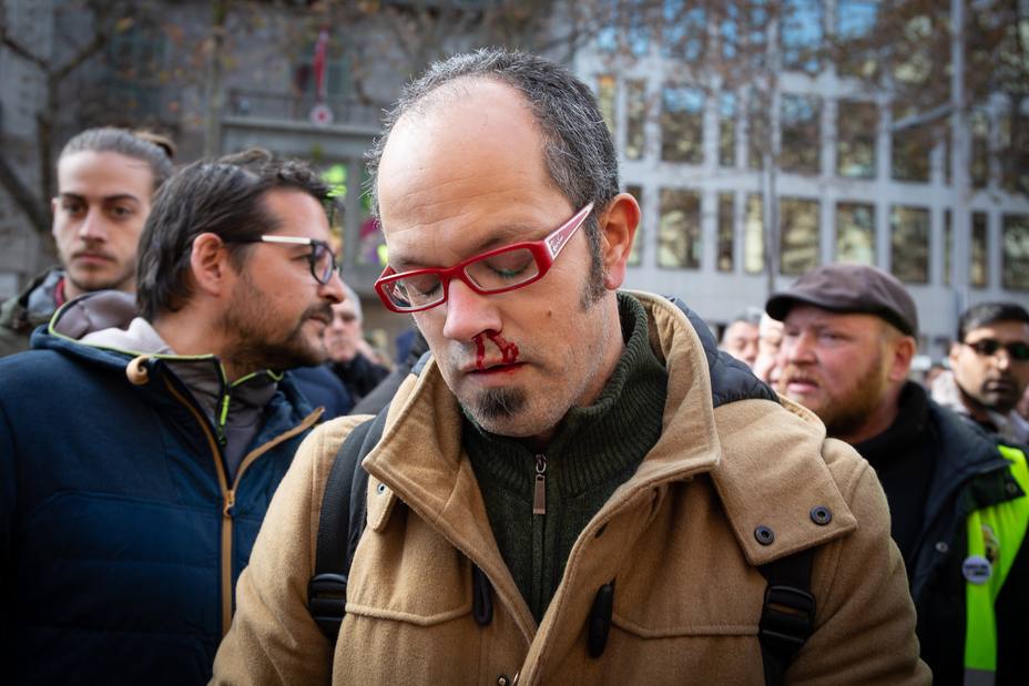 El periodista de El País, Alfonso Congostrina, tras ser agredido por los taxista de Barcelona