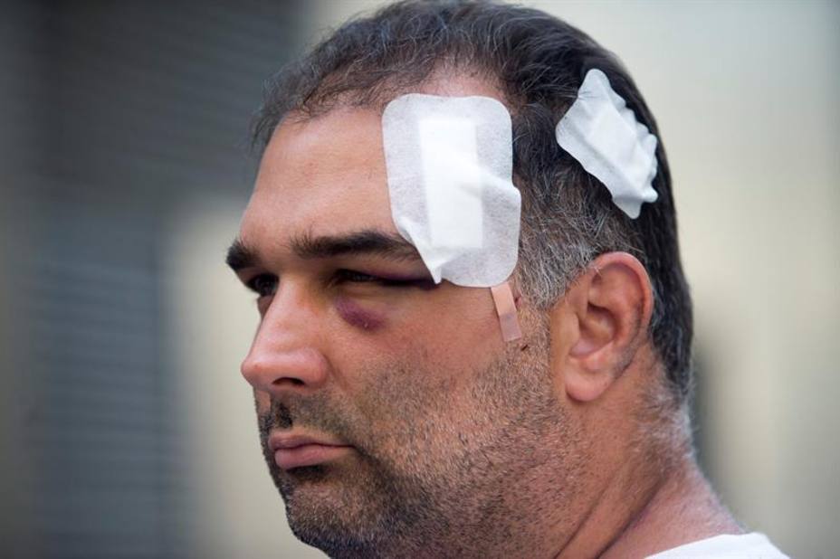 Detenido uno de los manteros que agredió a un turista en Barcelona