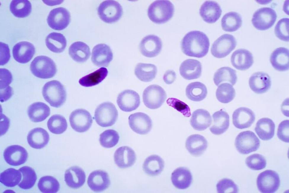 Investigadores consiguen combatir la malaria cerebral en ratones bloqueando una proteína