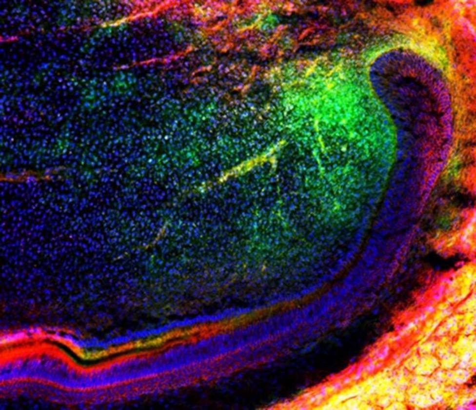 Científicos descubren nuevas células madre en ratones que podrían ayudar a la reparación de los dientes
