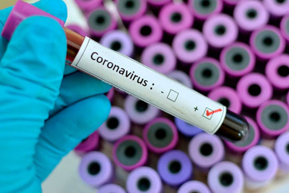 Positivo por coronavirus
