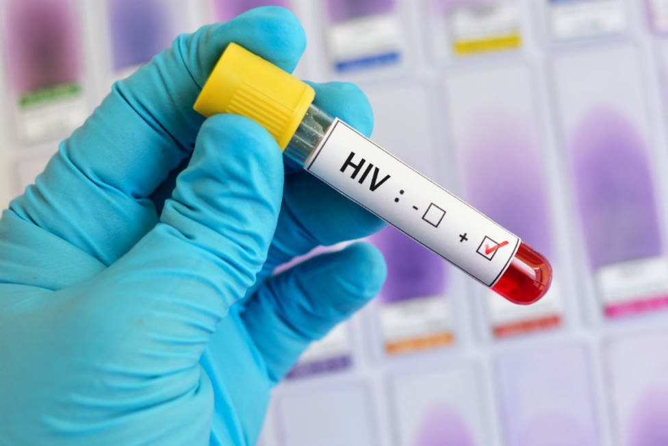 Científicos consideran curado a un segundo paciente de VIH doce años después