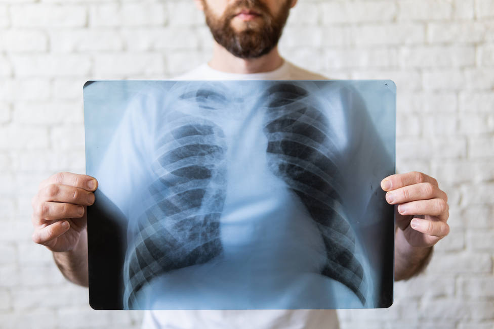 ¿Fortalecer los pulmones con ejercicios puede reducir el riesgo de covid?