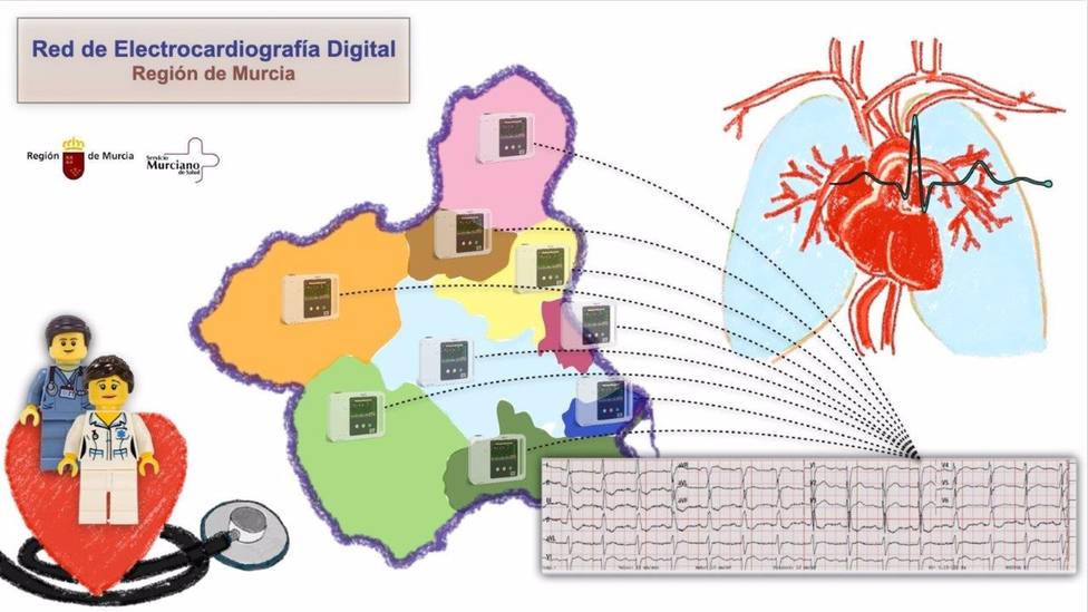 El SMS culmina la implantaciÃ³n de una innovadora red de electrocardiografÃ­a digital en la RegiÃ³n de Murcia